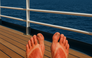 Can I Sue for Burnt Feet from Hot Deck on a Cruise Ship?